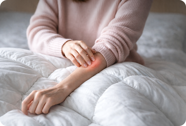 Think mosquitoes don’t bite in winter? Think again